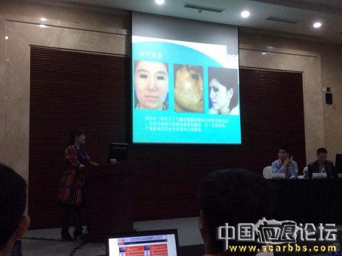 金嵐說疤痕-傷口好后怎樣預(yù)防留疤痕 ？[tag]