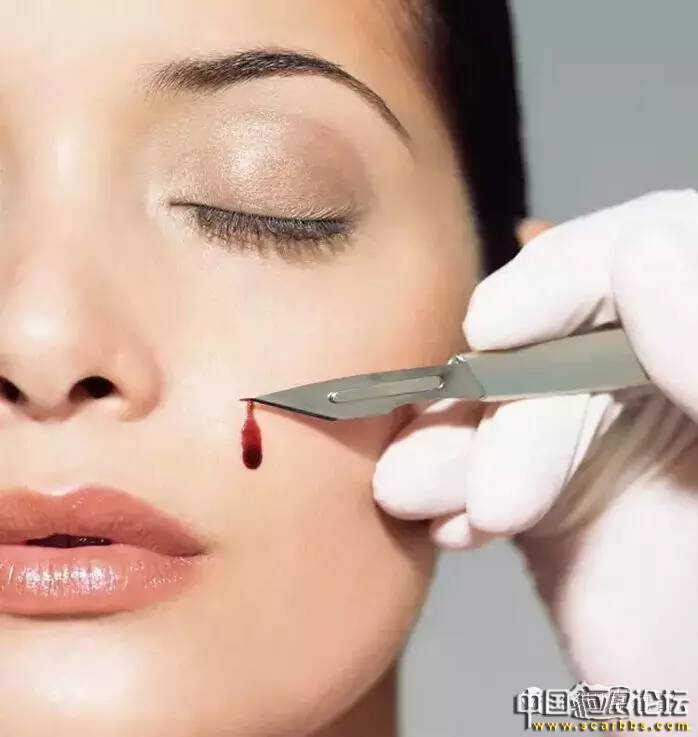 生活中的小意外造成的外傷疤痕如何修復？[tag]