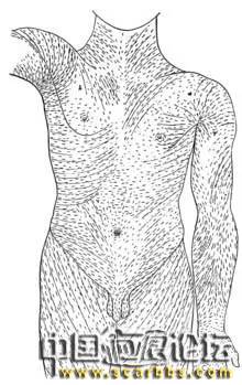 淺析外傷后的傷口縫合技術(shù)的重要性[tag]