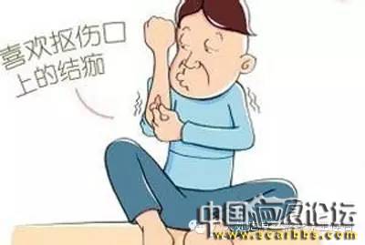 外傷疤痕的正確處理方法分享[tag]