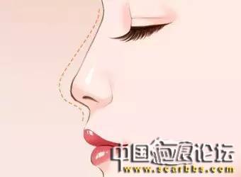 科普小知識(shí)：整形后的化妝方法介紹[tag]