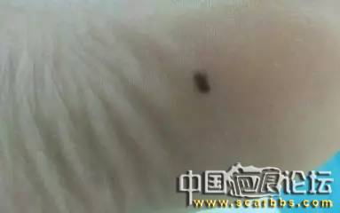 長痣的原因以及祛痣的正確處理方法分享[tag]