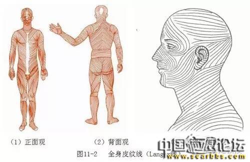 關(guān)于疤痕手術(shù)切除縫合術(shù)之直接切除縫合術(shù)介紹[tag]