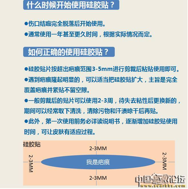 詳細(xì)介紹疤痕使用硅膠貼的技巧[tag]