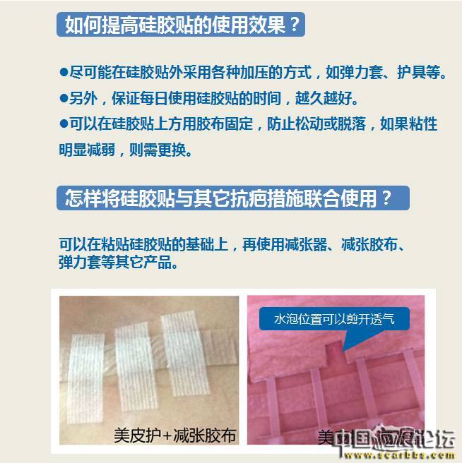 詳細(xì)介紹疤痕使用硅膠貼的技巧[tag]