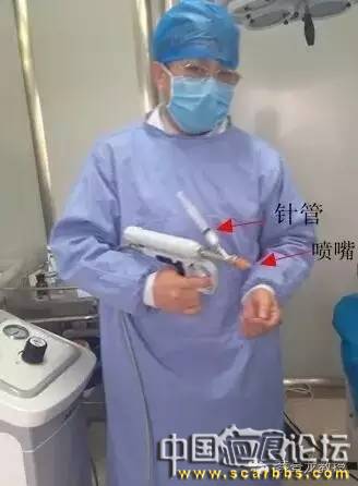 詳細介紹高壓無針瘢痕內(nèi)藥物注射治療增生性瘢痕和瘢痕疙瘩[tag]