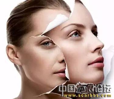 對(duì)于臉上的青春痘疤如何護(hù)理？[tag]