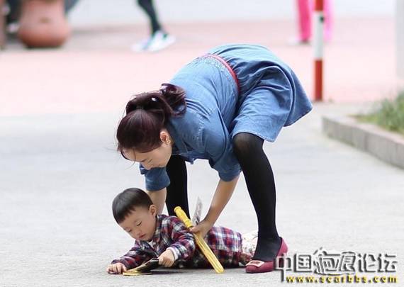 兒童摔傷疤痕后正確的護理很關鍵[tag]