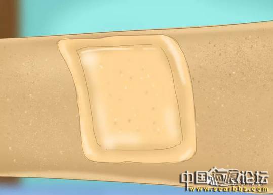 兒童摔傷、擦傷疤痕如何正確處理才能避免留疤？[tag]