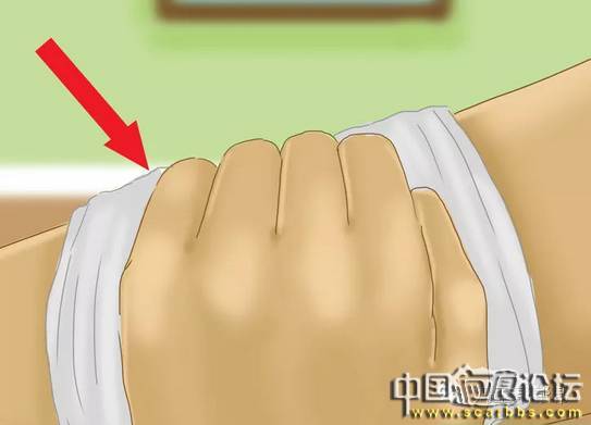 兒童摔傷、擦傷疤痕如何正確處理才能避免留疤？[tag]