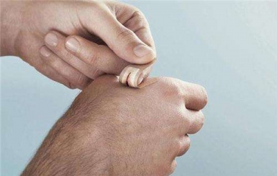 疤痕體質(zhì)如何去疤 妙招幫助自己消除疤痕[tag]