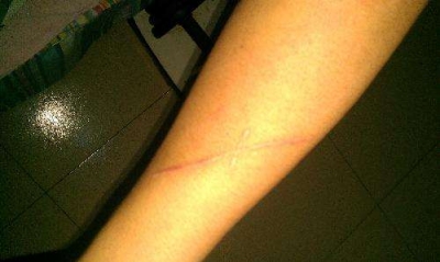 鴿子湯的功效促進傷口愈合 什么人適合喝鴿子湯最好[tag]