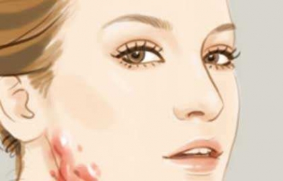 消除痘坑的小竅門(mén)[tag]