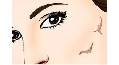 身上有疤痕五種辦法可以治療[tag]