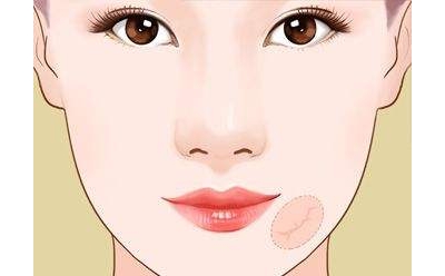 青春痘疤痕怎么去除[tag]