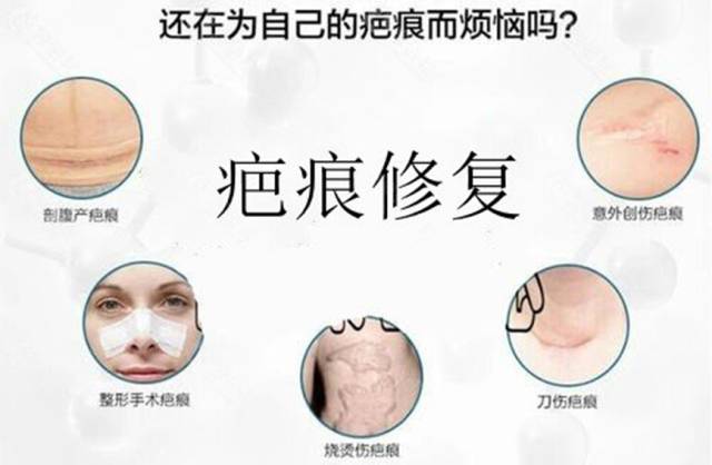 耳洞瘢痕疙瘩去除費用是多少[tag]