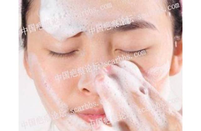 去痘印的有效方法[tag]