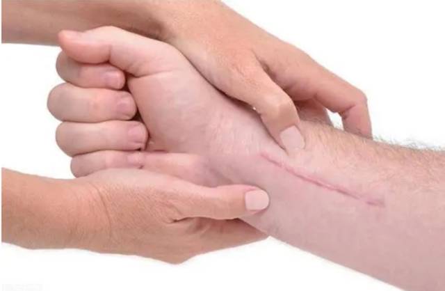 像素激光去痘印多少錢[tag]