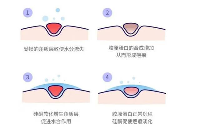 成都治療疤痕價格便宜的醫(yī)院[tag]